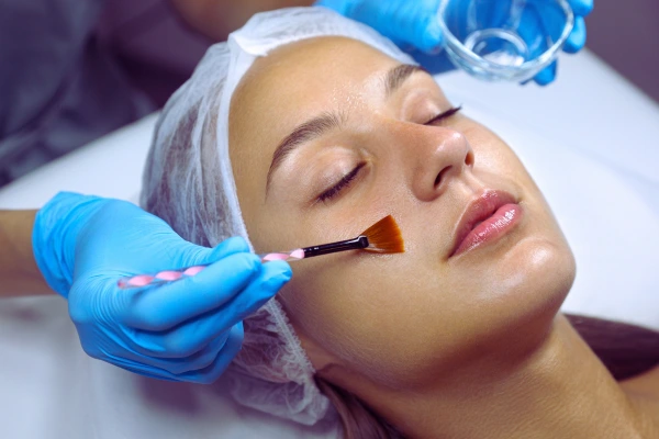Chemical peels at Sindhu Skin & Hair Clinic in Washim